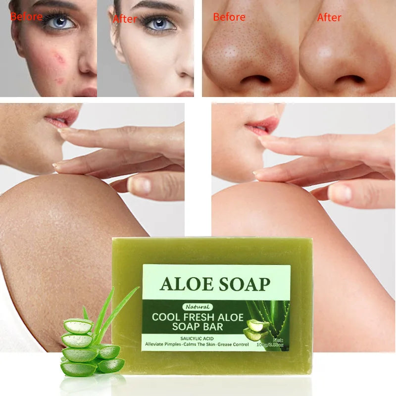 Vegan soap made with 99% pure Aloe Vera extract, removes acne, restores skin's radiance and softens fine lines.
