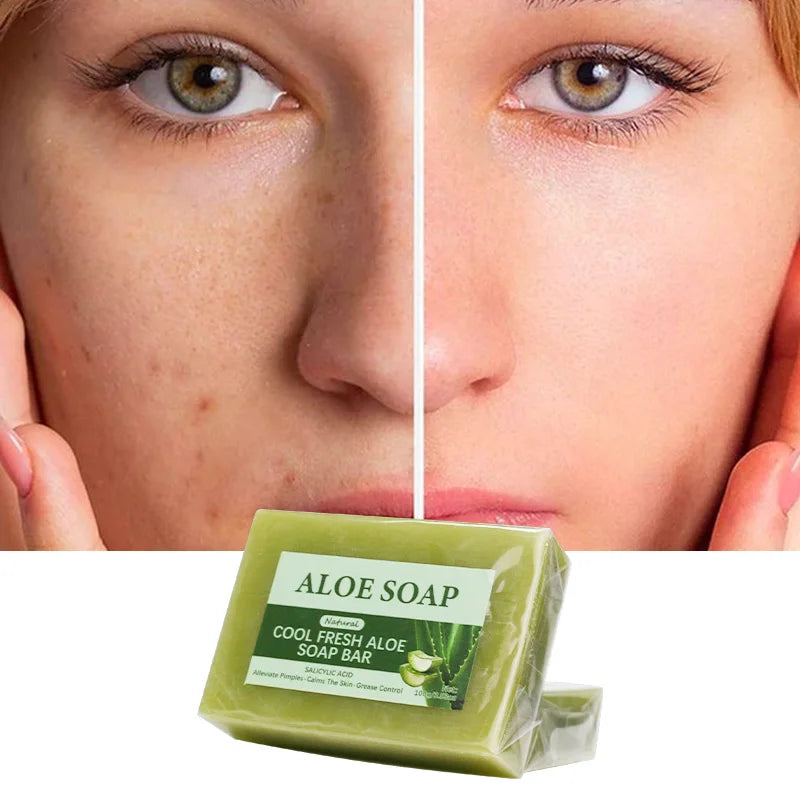 Vegan soap made with 99% pure Aloe Vera extract, removes acne, restores skin's radiance and softens fine lines.